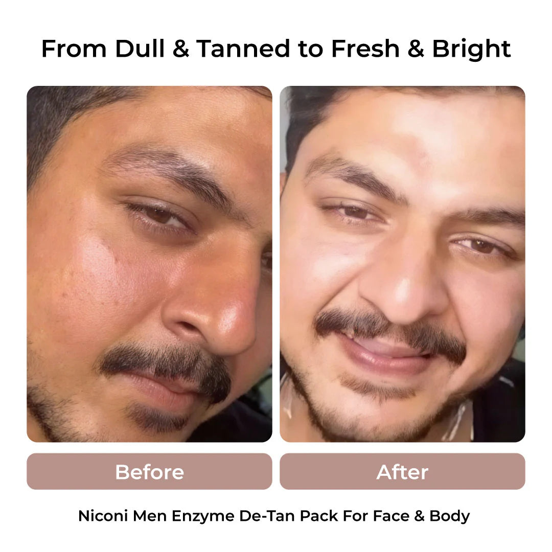 Niconi Men D Tan Cream